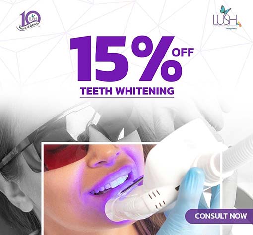 teeth-whitening